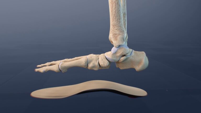 Golftechniken zur Vermeidung von &Uuml;berlastung